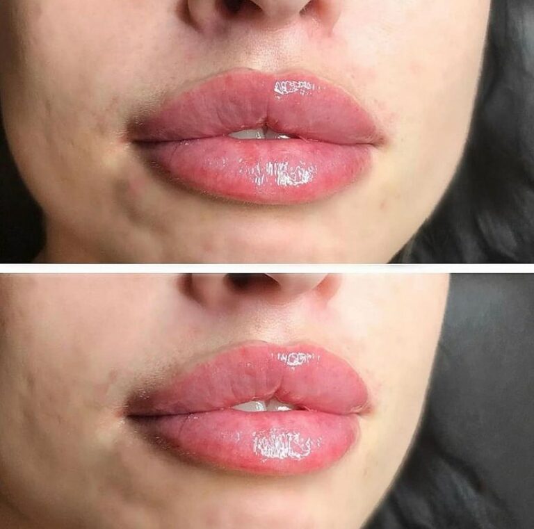 lips-angles